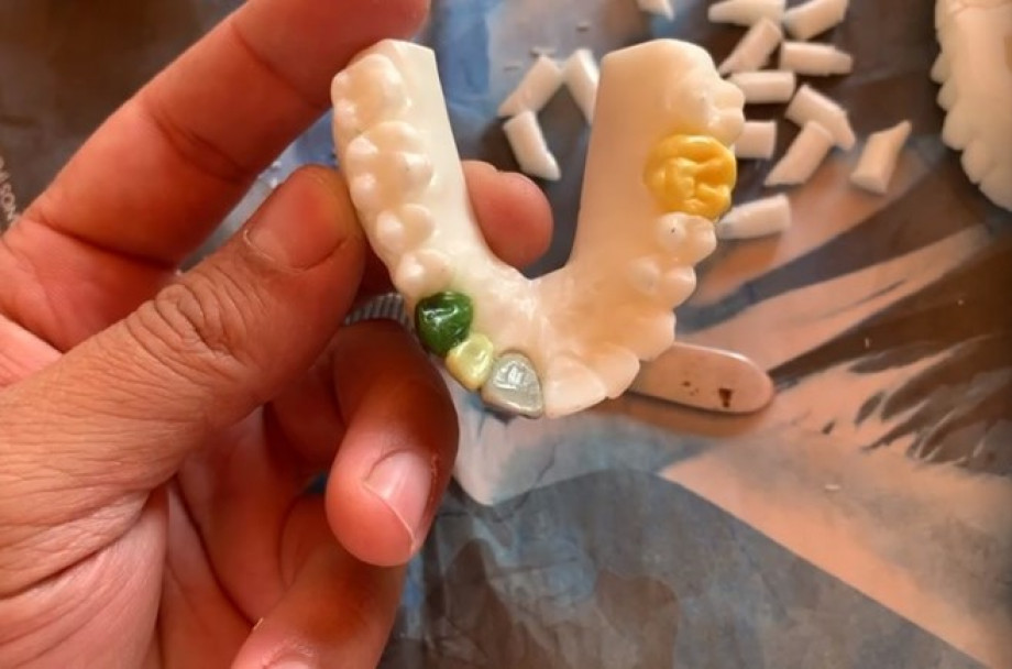 Estudantes de Odontologia recebem biomodelos de arcada dentária para treinar em casa